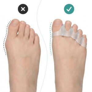 Alternative view of OrthoRelax® – Gél Lábujj Elválasztó (2 elválasztó)
