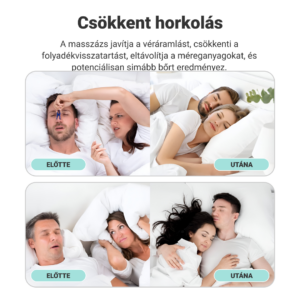Alternative view of SLEEPDREAM ®️ Kényelmes horkolásgátló eszköz (2+2 INGYEN)