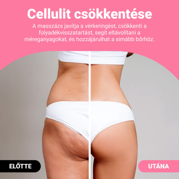 GUASHA – testformáló masszázshenger a cellulit és zsír látható csökkentésére - Image 2